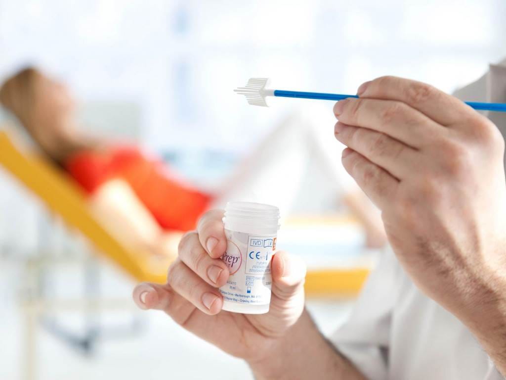 pap smear test