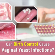 vaginal yeast infection causes women, birth control, yeast infection discharge pictures, birth control side effects
