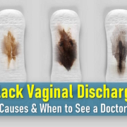 What Does Black Discharge Mean, Black Discharge No Period, after period, before period, 2 Weeks After Period