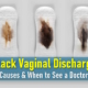 What Does Black Discharge Mean, Black Discharge No Period, after period, before period, 2 Weeks After Period