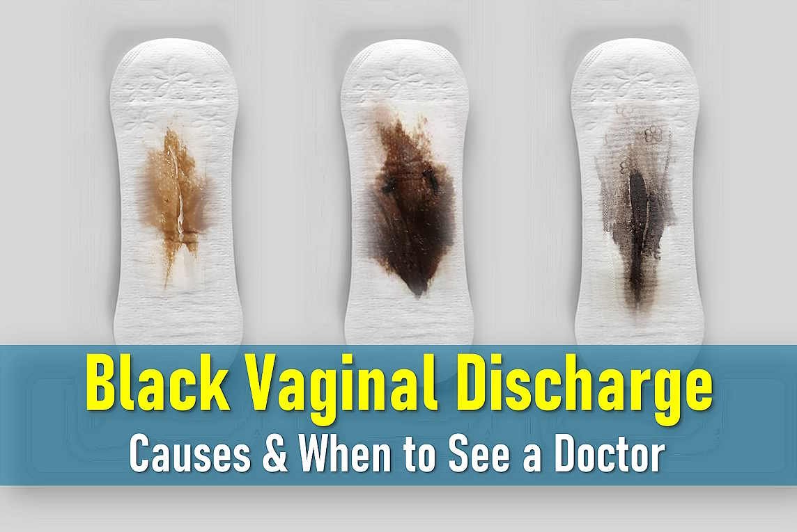 What Does Black Discharge Mean, Black Discharge No Period, after period, before period, 2 Weeks After Period