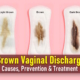 What Causes Brown Vaginal Discharge Before or After Period