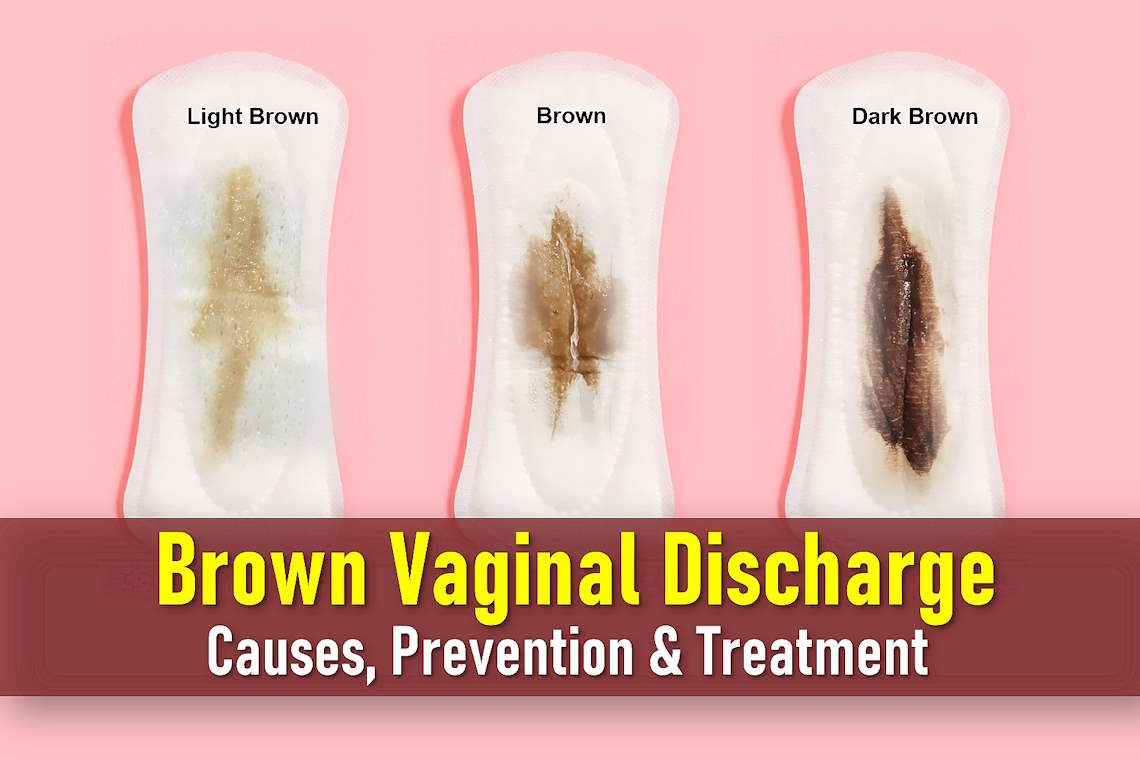 What Causes Brown Vaginal Discharge Before or After Period
