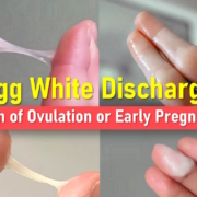 egg white discharge before period, early pregnancy Egg White Discharge After Ovulation, EWCM, Cervical Mucus