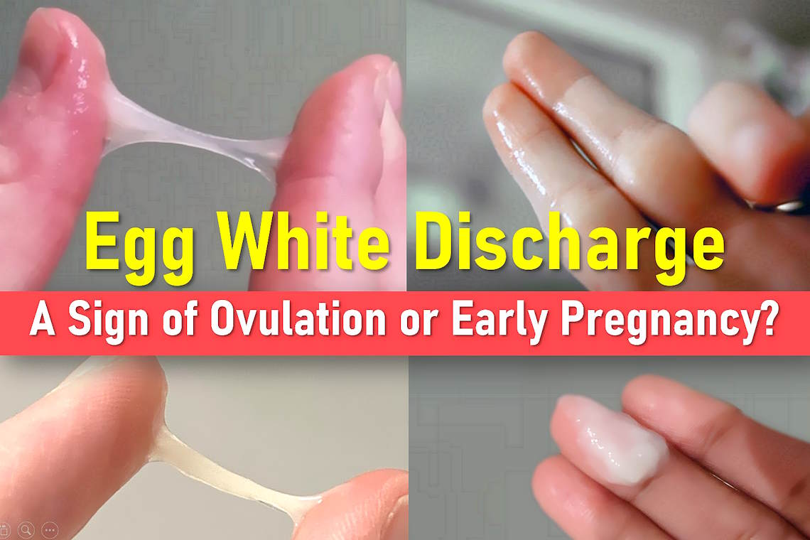 White Cervical Mucus Early Pregnancy