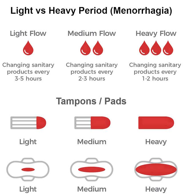 heavy periods, very heavy periods with clots, normal, causes, immediate treatment 