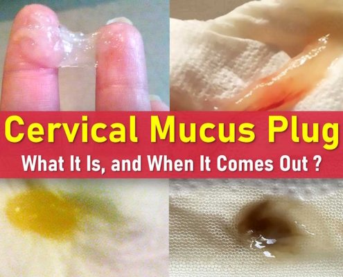 mucus plug, what does a mucus plug look like, mucus plug pictures, mucus plug vs discharge pictures