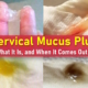 mucus plug, what does a mucus plug look like, mucus plug pictures, mucus plug vs discharge pictures