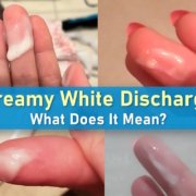 white creamy discharge before period, creamy white discharge, white discharge mean, thick, milky