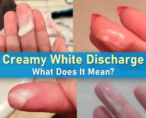 white creamy discharge before period, creamy white discharge, white discharge mean, thick, milky