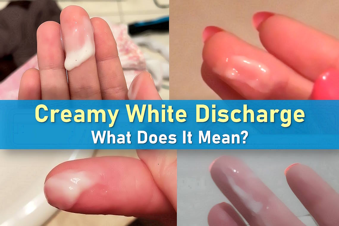 white creamy discharge before period, creamy white discharge, white discharge mean, thick, milky