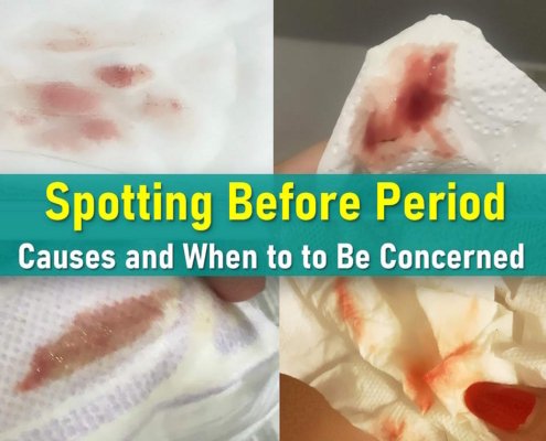spotting between periods, spotting during ovulation, pictures of spotting, spotting after sex could I be pregnant