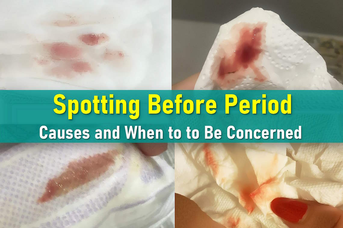 spotting between periods, spotting during ovulation, pictures of spotting, spotting after sex could I be pregnant