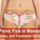 lower abdominal pain in women, pelvic pain during pregnancy, pelvic pain after sex, where is pelvic pain located