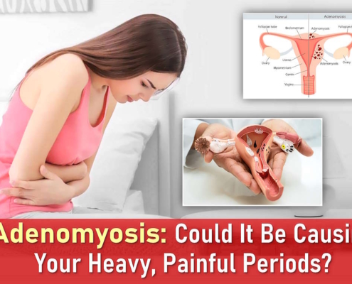 adenomyosis symptoms, real adenomyosis pictures, adenomyosis vs endometriosis pain, adenomyosis cause painful periods