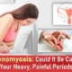 adenomyosis symptoms, real adenomyosis pictures, adenomyosis vs endometriosis pain, adenomyosis cause painful periods