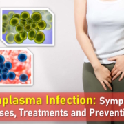 ureaplasma, ureaplasma symptoms, ureaplasma urealyticum, ureaplasma parvum, ureaplasma treatment, ureaplasma spp naa