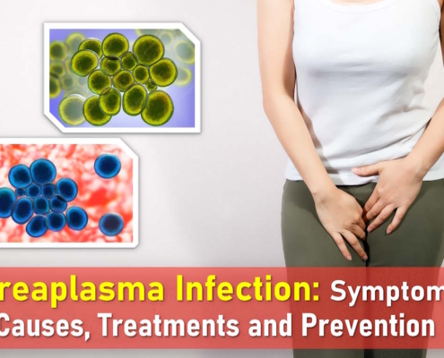 ureaplasma, ureaplasma symptoms, ureaplasma urealyticum, ureaplasma parvum, ureaplasma treatment, ureaplasma spp naa