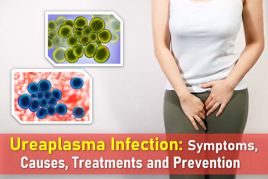 ureaplasma, ureaplasma symptoms, ureaplasma urealyticum, ureaplasma parvum, ureaplasma treatment, ureaplasma spp naa