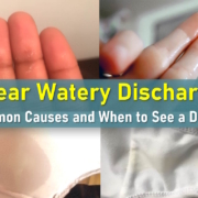 what does watery discharge mean, clear discharge, watery discharge before period, clear discharge before period, after sex