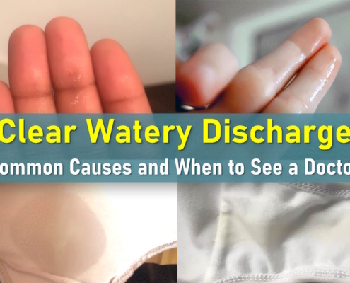 what does watery discharge mean, clear discharge, watery discharge before period, clear discharge before period, after sex
